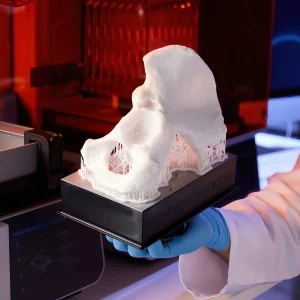 Anatomisches Beckenmodell mit Stützstrukturen auf der Bauplattform des Formlabs Form 4B